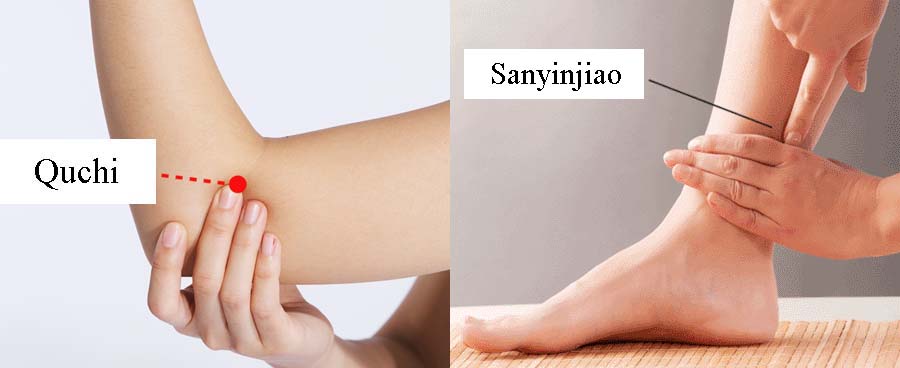 acupressure acne 2