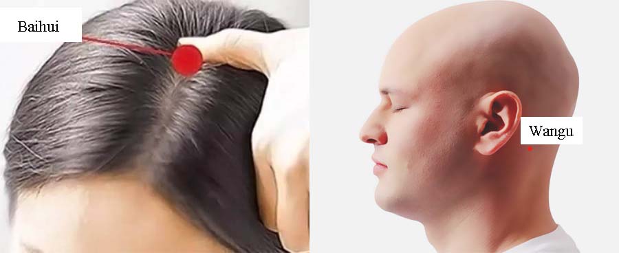 acupressure hair loss 3