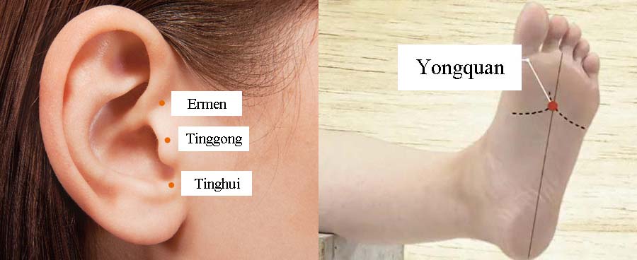 acupressure tinnitus 3