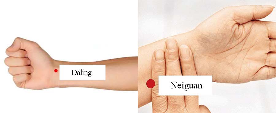 acupressure wrist pain 1